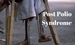 Post polio syndrome