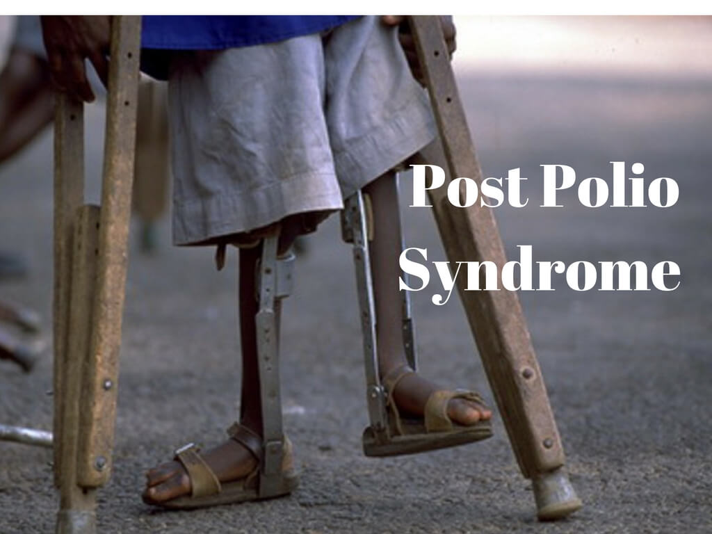 Post polio syndrome